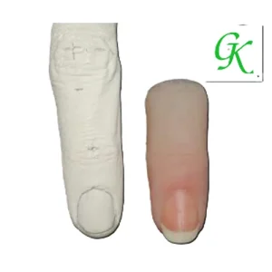 Ngón tay giả thẩm mỹ